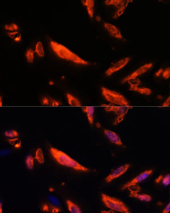 100UL LRRC7 ANTIBODY 100 ul