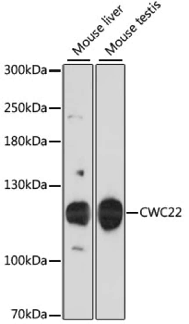 100UL CWC22 ANTIBODY 100 ul