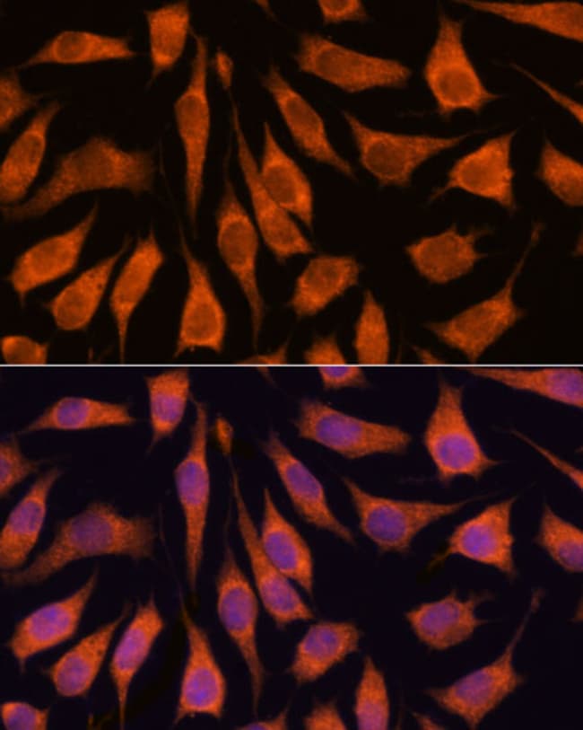 100UL GOLPH3 ANTIBODY 100 ul