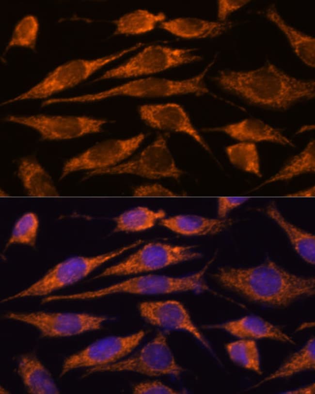 100UL MTMR9 ANTIBODY 100 ul