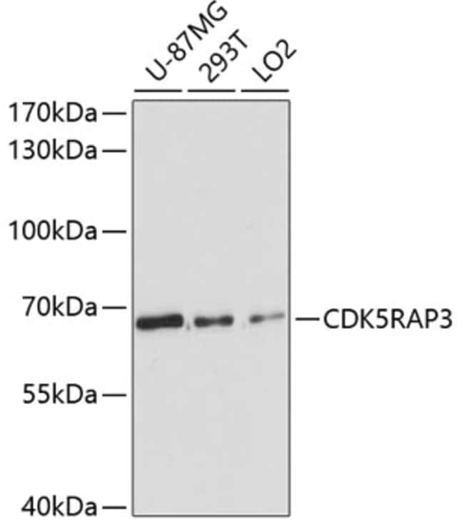 100UL CDK5RAP3 ANTIBODY 100 ul