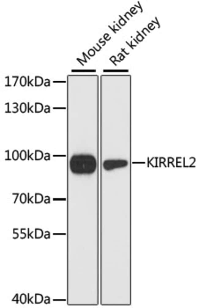 100UL KIRREL2 ANTIBODY 100 ul