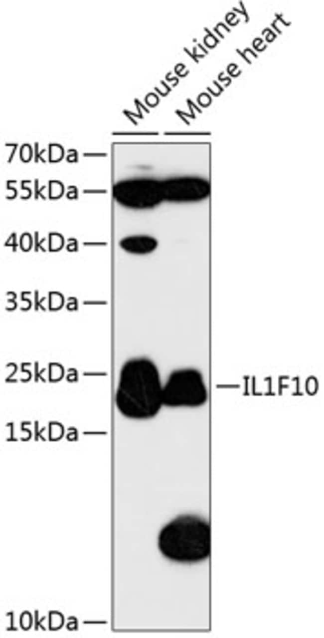 100UL IL1F10 ANTIBODY 100 ul