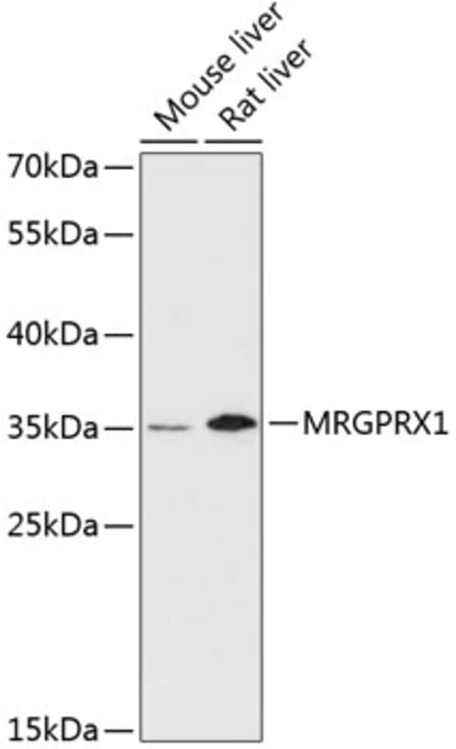 100UL MRGPRX1 ANTIBODY 100 ul