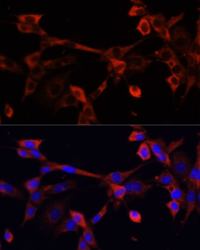 100UL DNASE1L1 ANTIBODY 100 ul