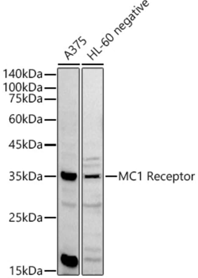 100UL MC1R ANTIBODY 100 ul