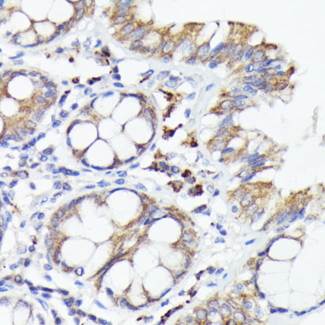 100UL IL-1 ALPHA ANTIBODY 100 ul