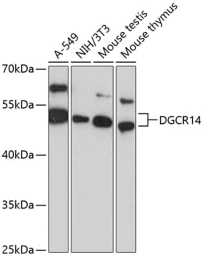 100UL DGCR14 ANTIBODY 100 ul