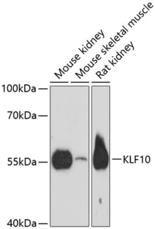 100UL KLF10 ANTIBODY 100 ul