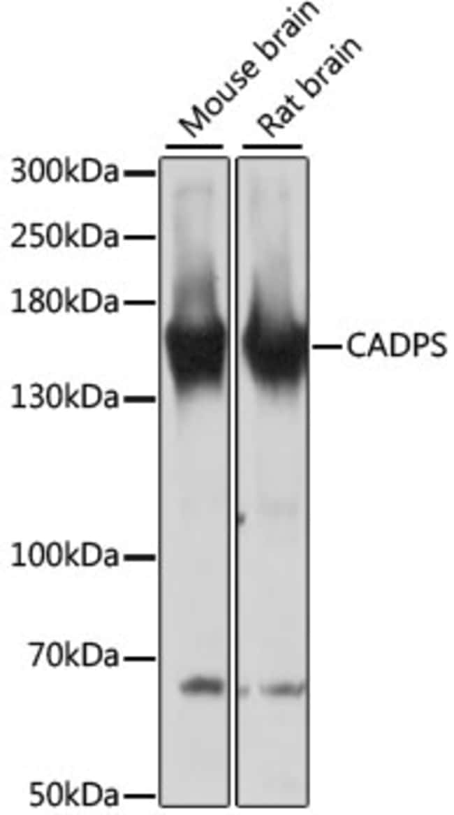 100UL CAPS1 ANTIBODY 100 ul