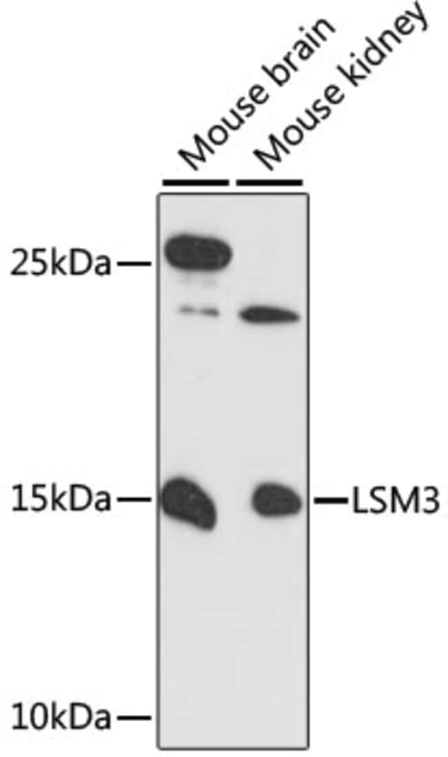 100UL LSM3 ANTIBODY 100 ul
