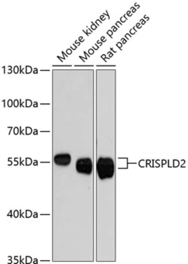 100UL CRISPLD2 ANTIBODY 100 ul