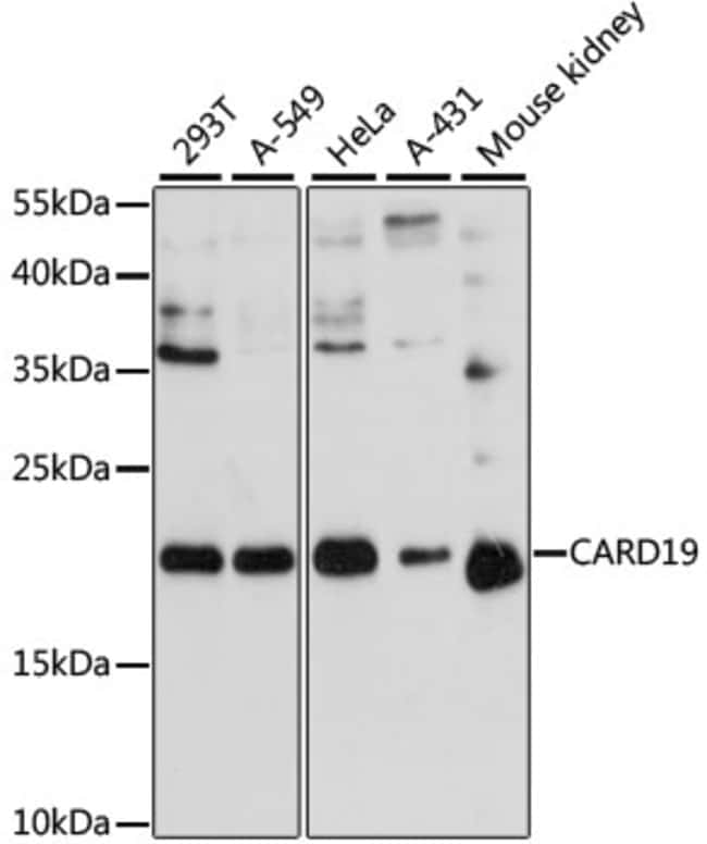 100UL C9ORF89 ANTIBODY 100 ul