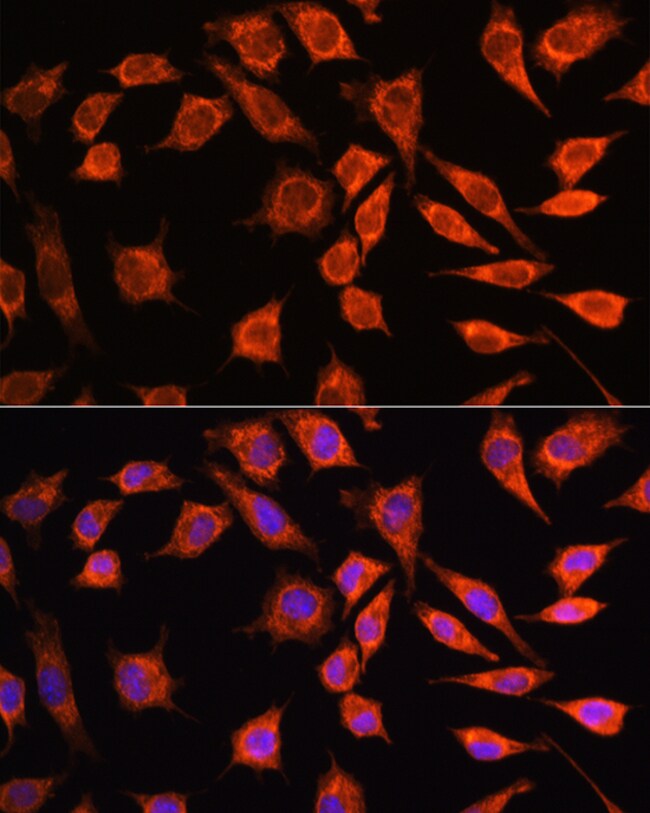 100UL MRPL45 ANTIBODY 100 ul
