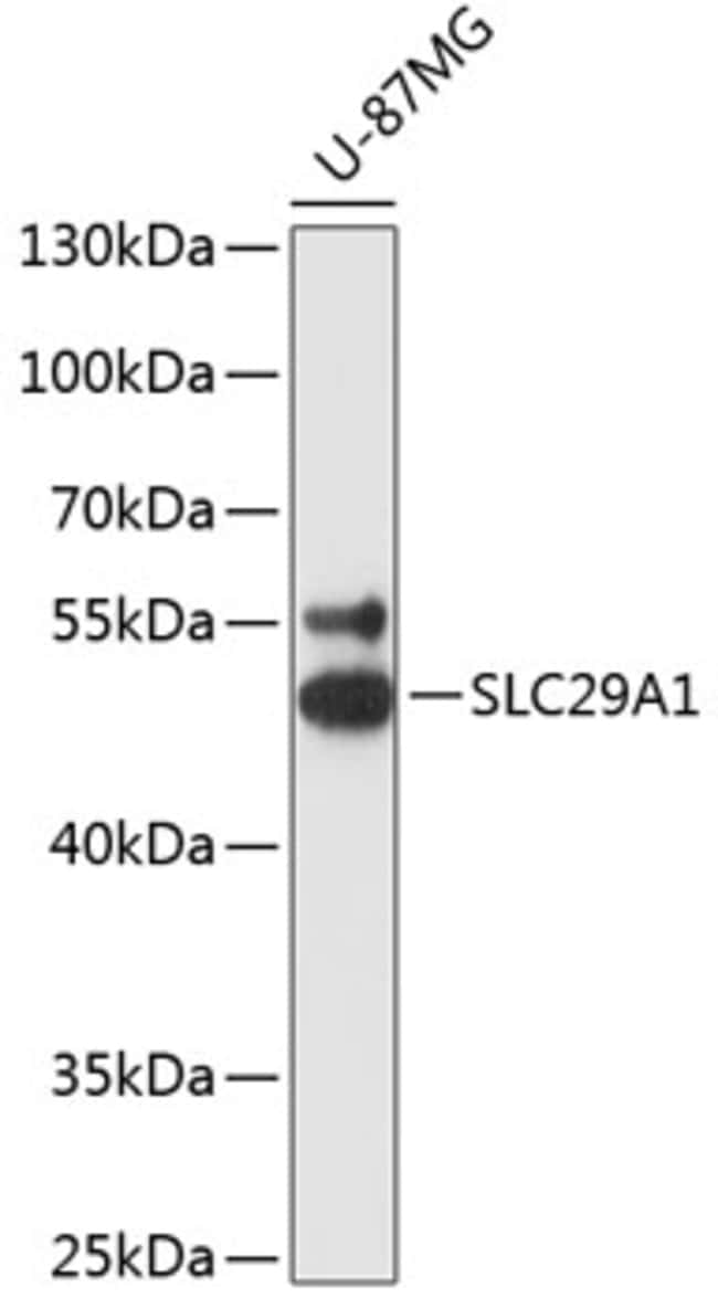100UL ENT1 ANTIBODY 100 ul