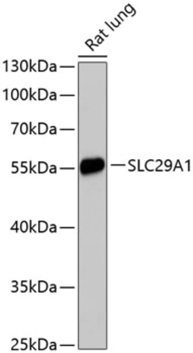 100UL ENT1 ANTIBODY 100 ul