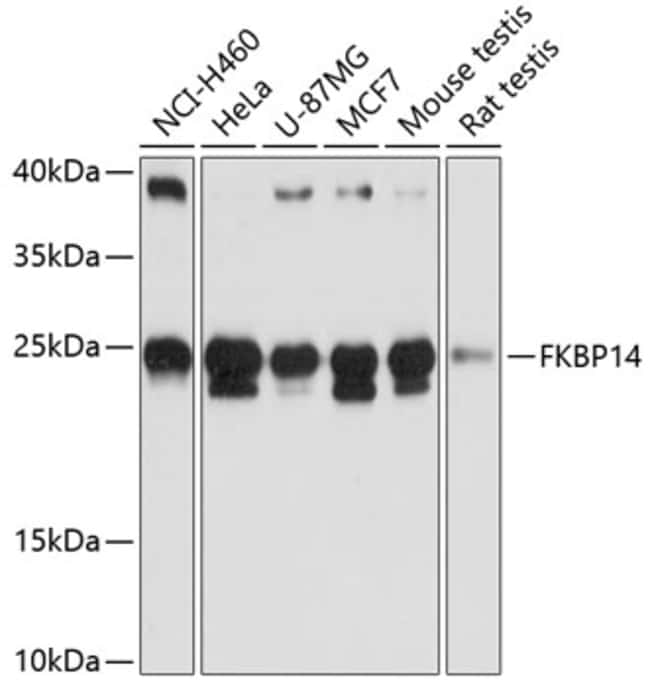 100UL FKBP14 ANTIBODY 100 ul