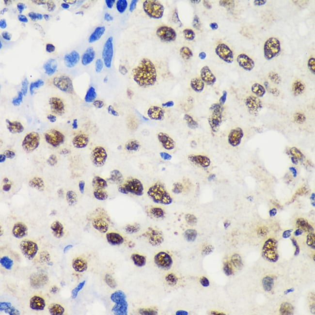 100UL LARP2 ANTIBODY 100 ul