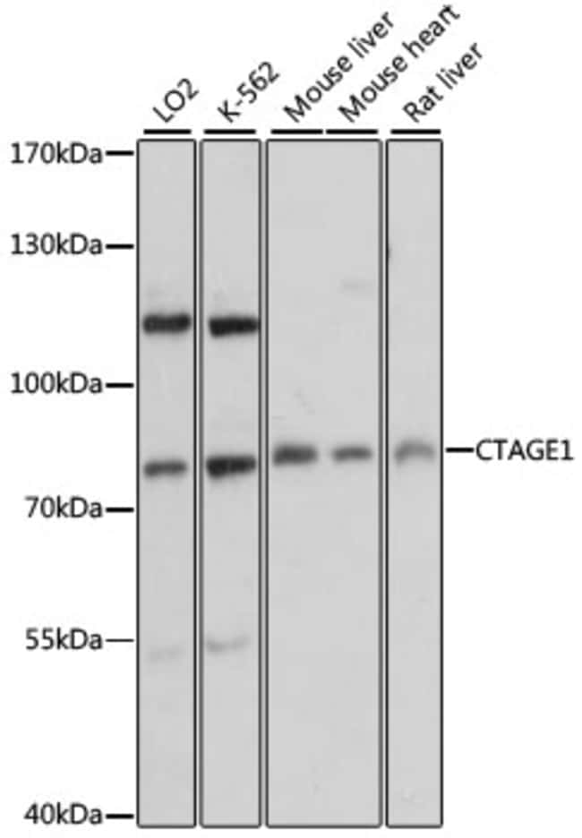 100UL CTAGE1 ANTIBODY 100 ul