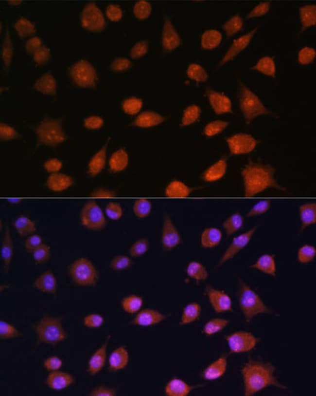 100UL AROS ANTIBODY 100 ul
