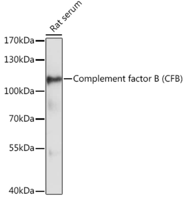 100UL COMPLEMENT FACTOR B ANTIBODY 100 u