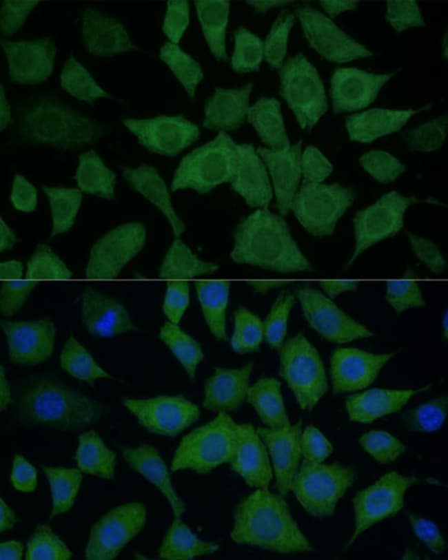 100UL IDH1 ANTIBODY 100 ul