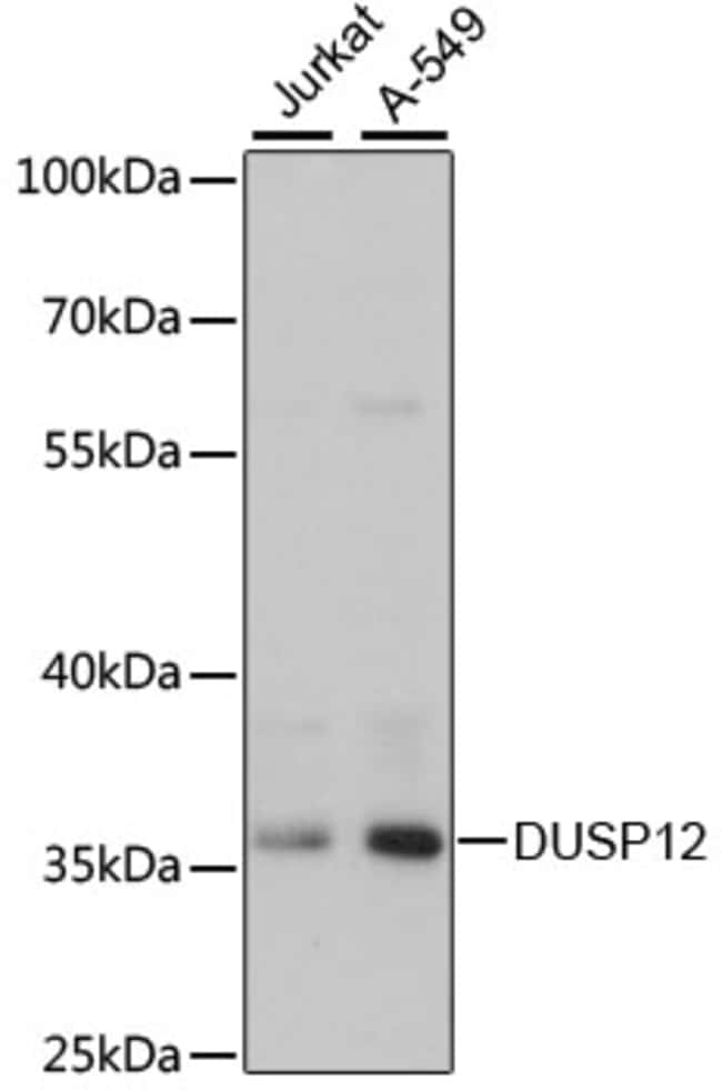 100UL DUSP12 ANTIBODY 100 ul