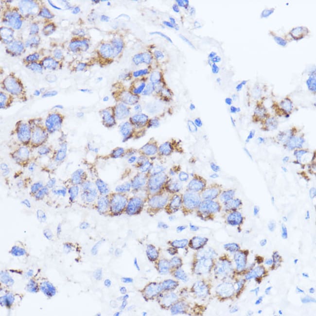 100UL ACAT1 ANTIBODY 100 ul