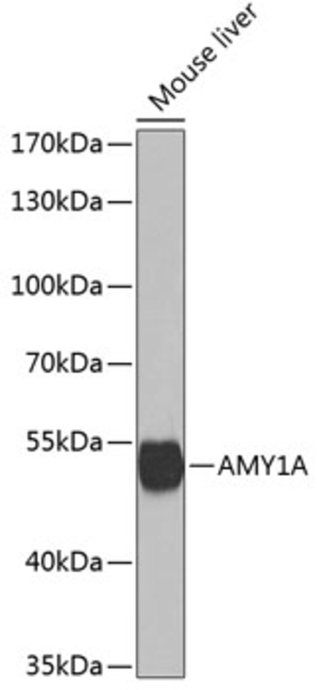 100UL ALPHA AMYLASE 1 ANTIBODY 100 ul