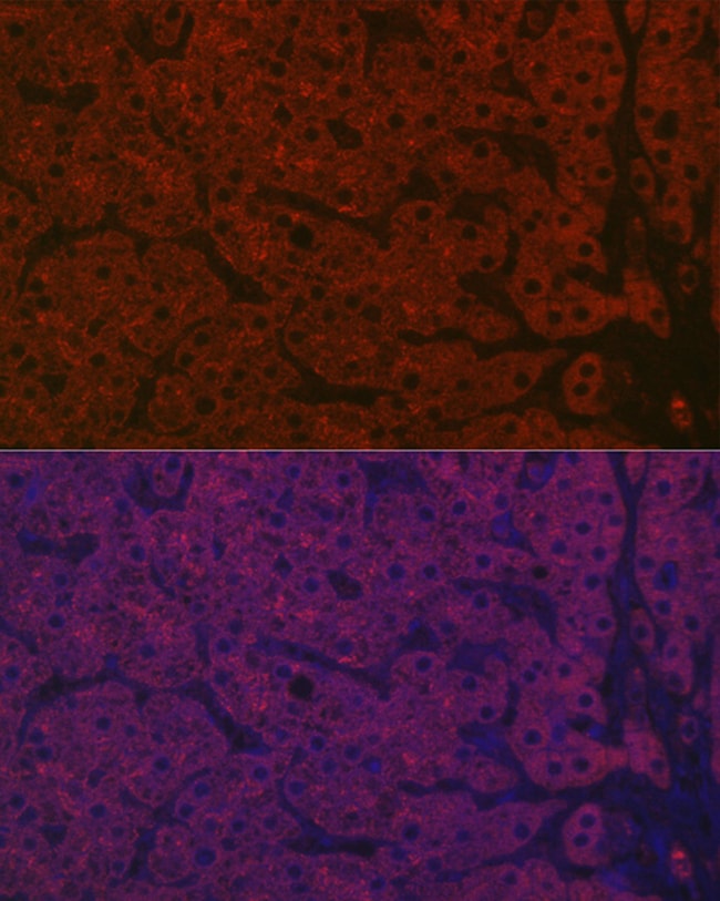 100UL ASGR1 ANTIBODY 100 ul
