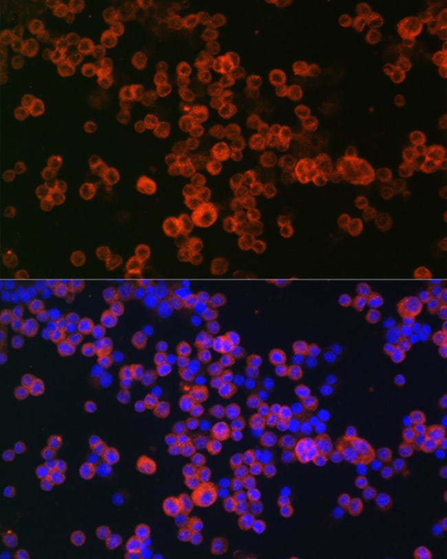 100UL CD68 ANTIBODY 100 ul