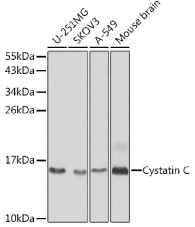 100UL CYSTATIN C ANTIBODY 100 ul