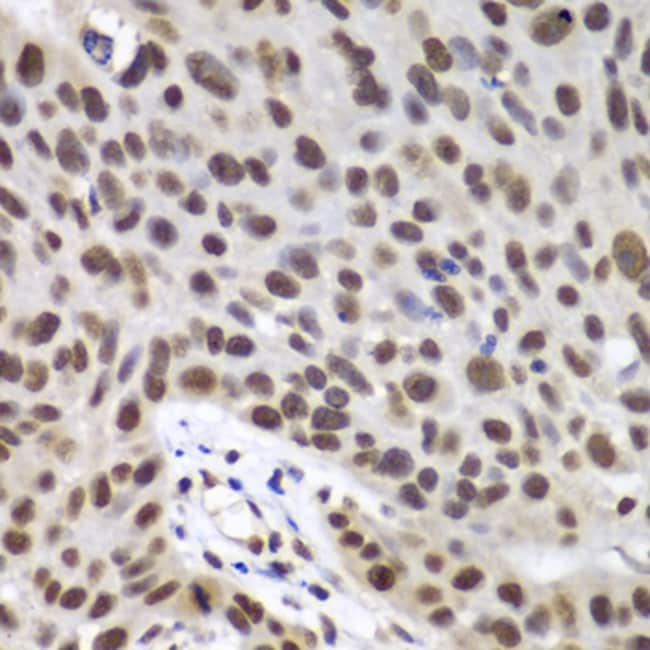 100UL DDX5 ANTIBODY 100 ul