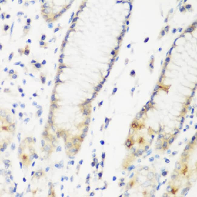 100UL DHODH ANTIBODY 100 ul