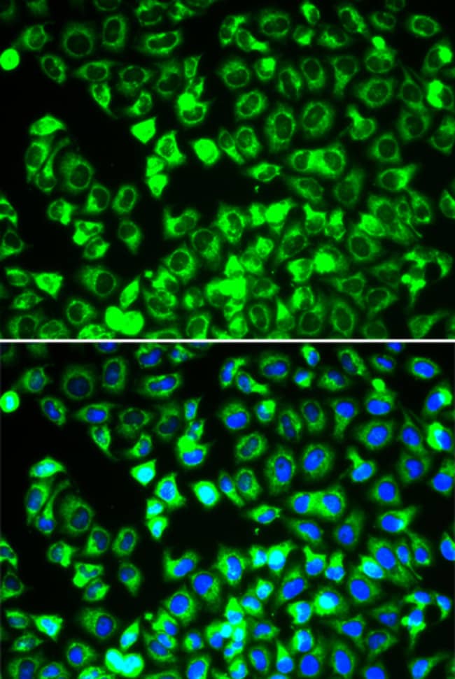 100UL DLD ANTIBODY 100 ul