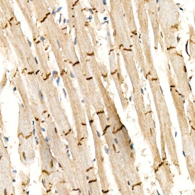 100UL DESMOPLAKIN ANTIBODY 100 ul