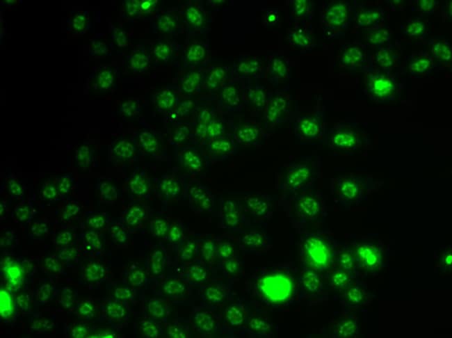 100UL ETV1 ANTIBODY 100 ul