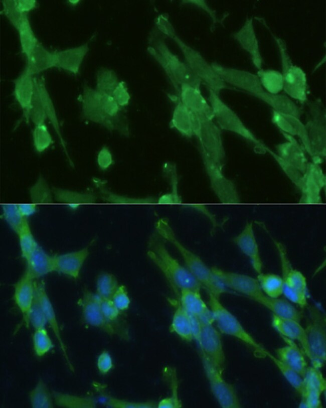 100UL GPI ANTIBODY 100 ul