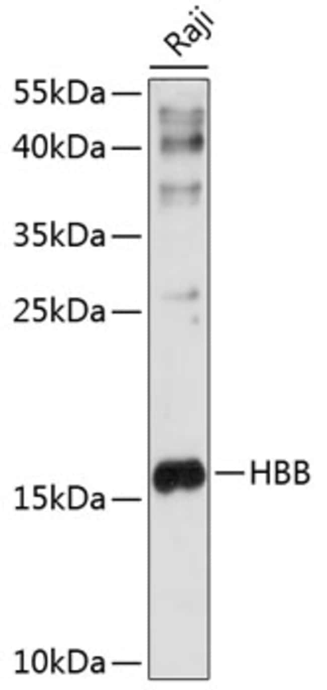 100UL HBB ANTIBODY 100 ul