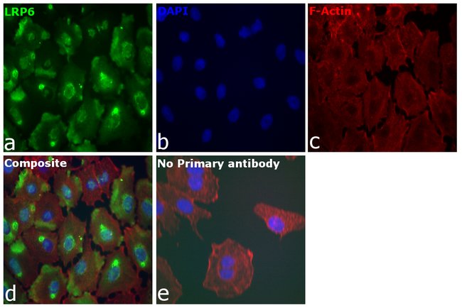 100UL LRP6 ANTIBODY 100 ul