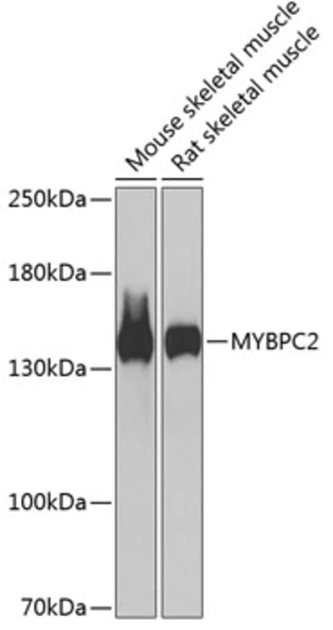 100UL MYBPC2 ANTIBODY 100 ul