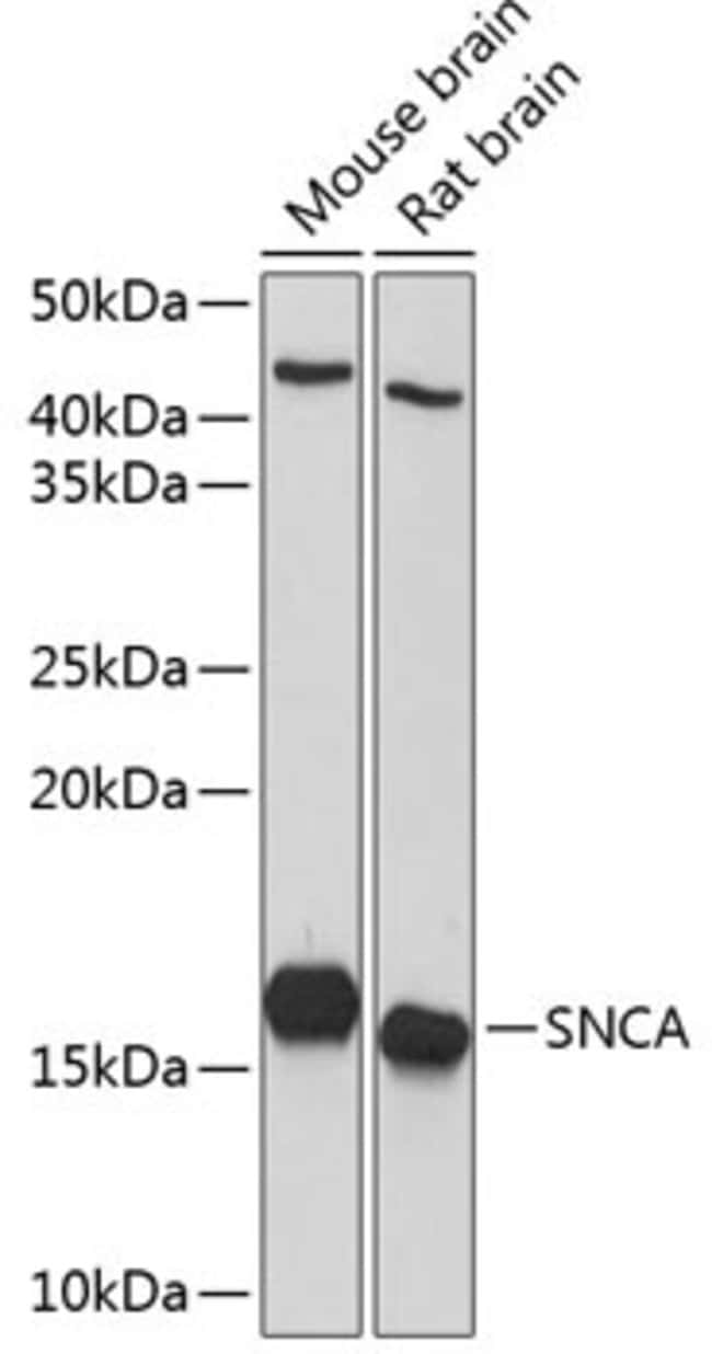 100UL ALPHA SYNUCLEIN ANTIBODY 100 ul