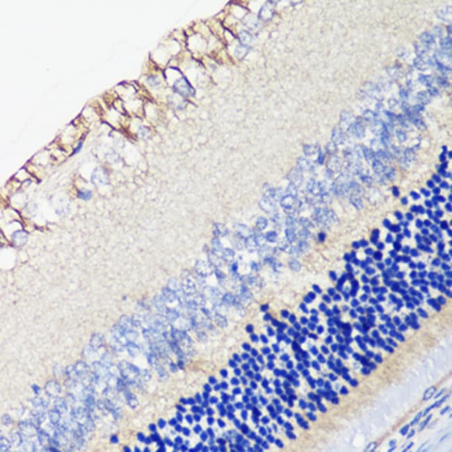 100UL D4 DOPAMINE RECEPTOR ANTIBODY 100