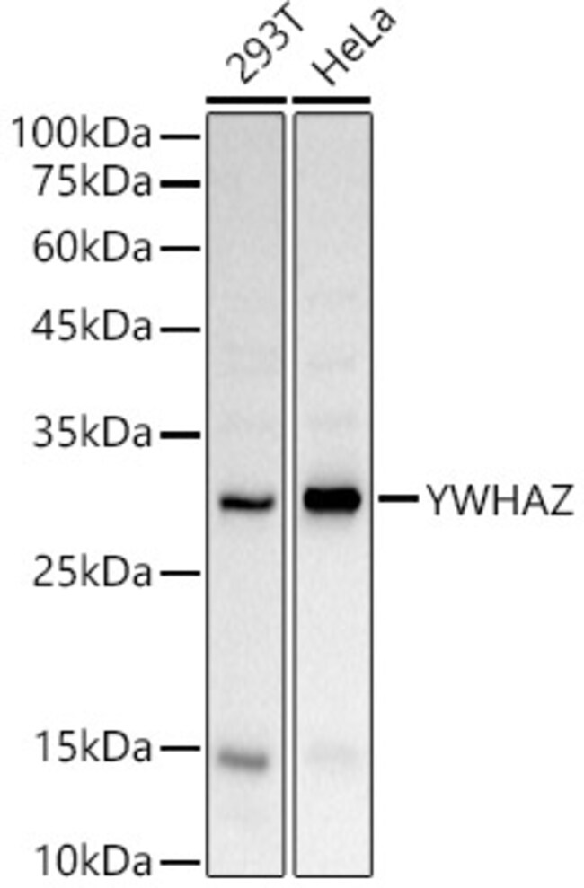 100UL 14-3-3 ZETA ANTIBODY 100 ul
