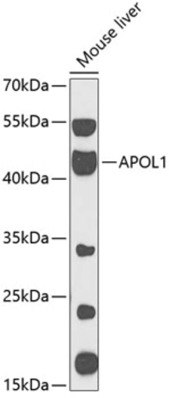 100UL APOLIPOPROTEIN L1 ANTIBODY 100 ul