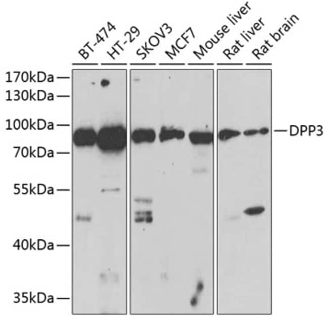 100UL DPP3 ANTIBODY 100 ul