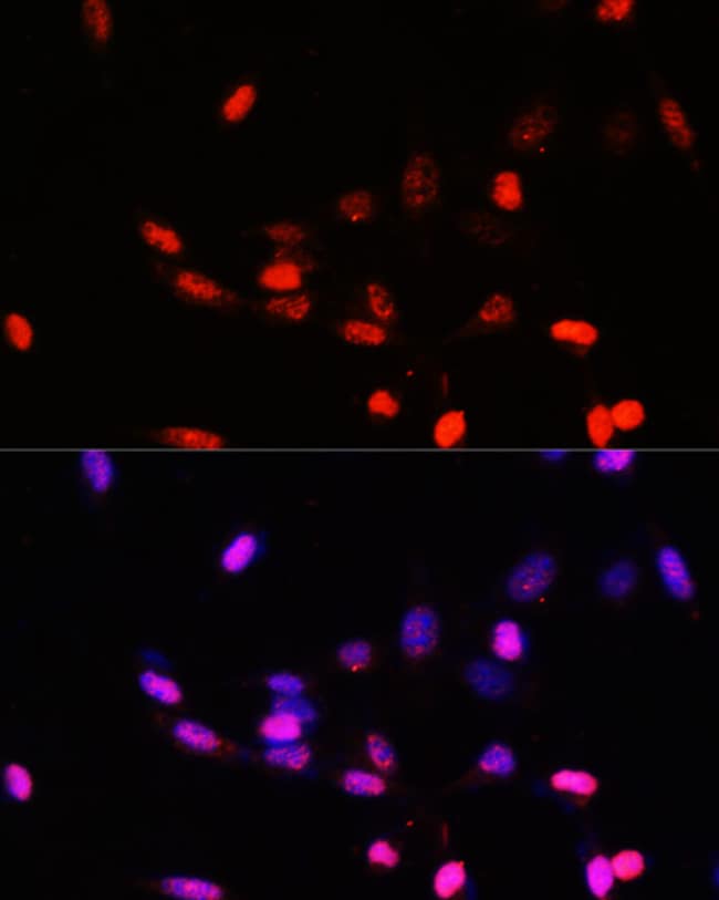 100UL JAB1 ANTIBODY 100 ul