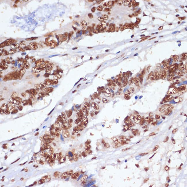 100UL MNAR ANTIBODY 100 ul