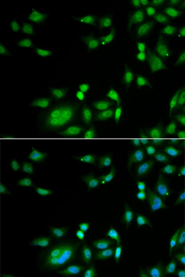 100UL INTS10 ANTIBODY 100 ul