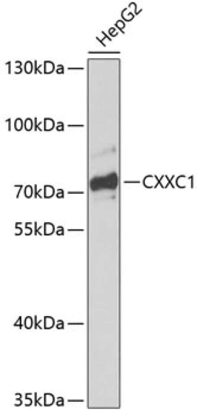 100UL CGBP ANTIBODY 100 ul